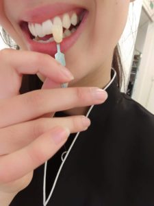 dentist Claremont tooth whitening oral b whitening strips