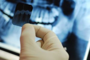 dentist Perth Claremont dental x-rays cosmetic dentistry Invisalign