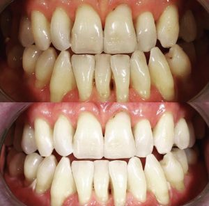 affordable cosmetic dentistry Claremont dental Perth dentist smile makeover