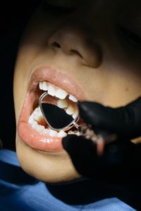 does tooth decay matter claremont dental dentist Perth