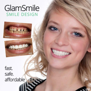 glamsmile Perth dentist Claremont dental Perth cosmetic dentistry