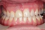 richard after Dentist Claremont Cosmetic Dentist Perth Claremont Dental