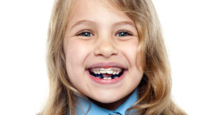 does my child need braces orthodontics Perth dentist Claremont dental
