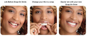 snap on smile Perth dentist Claremont dental