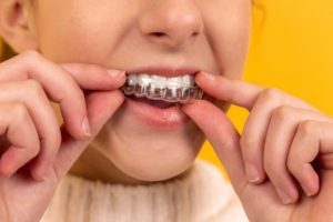 what age to have Invisalign clear aligners Claremont dental Perth dentist